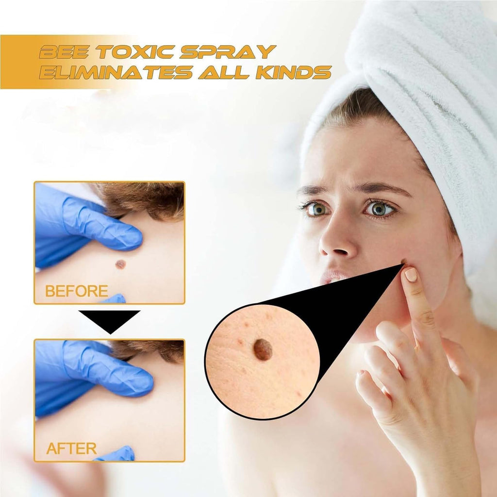 TagRecede™ Wart Remover Spray